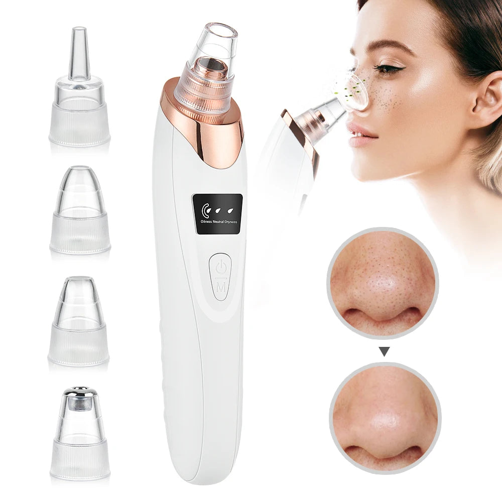 MB Mart® Vacuum Blackhead Remover – Deep Pore Cleaner for Clear Skin