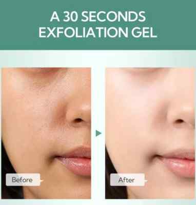 MB Mart® BIOAQUA Peeling Gel | Brightening, Exfoliating & Skin Renewing Formula